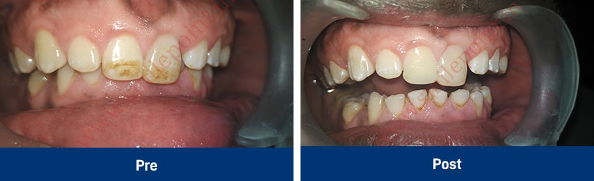 Aesthetic Procedures