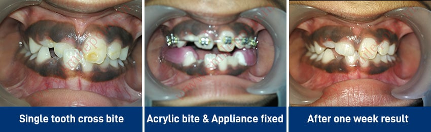 Child Care Dentistry