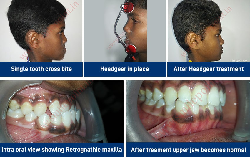 Child Care Dentistry